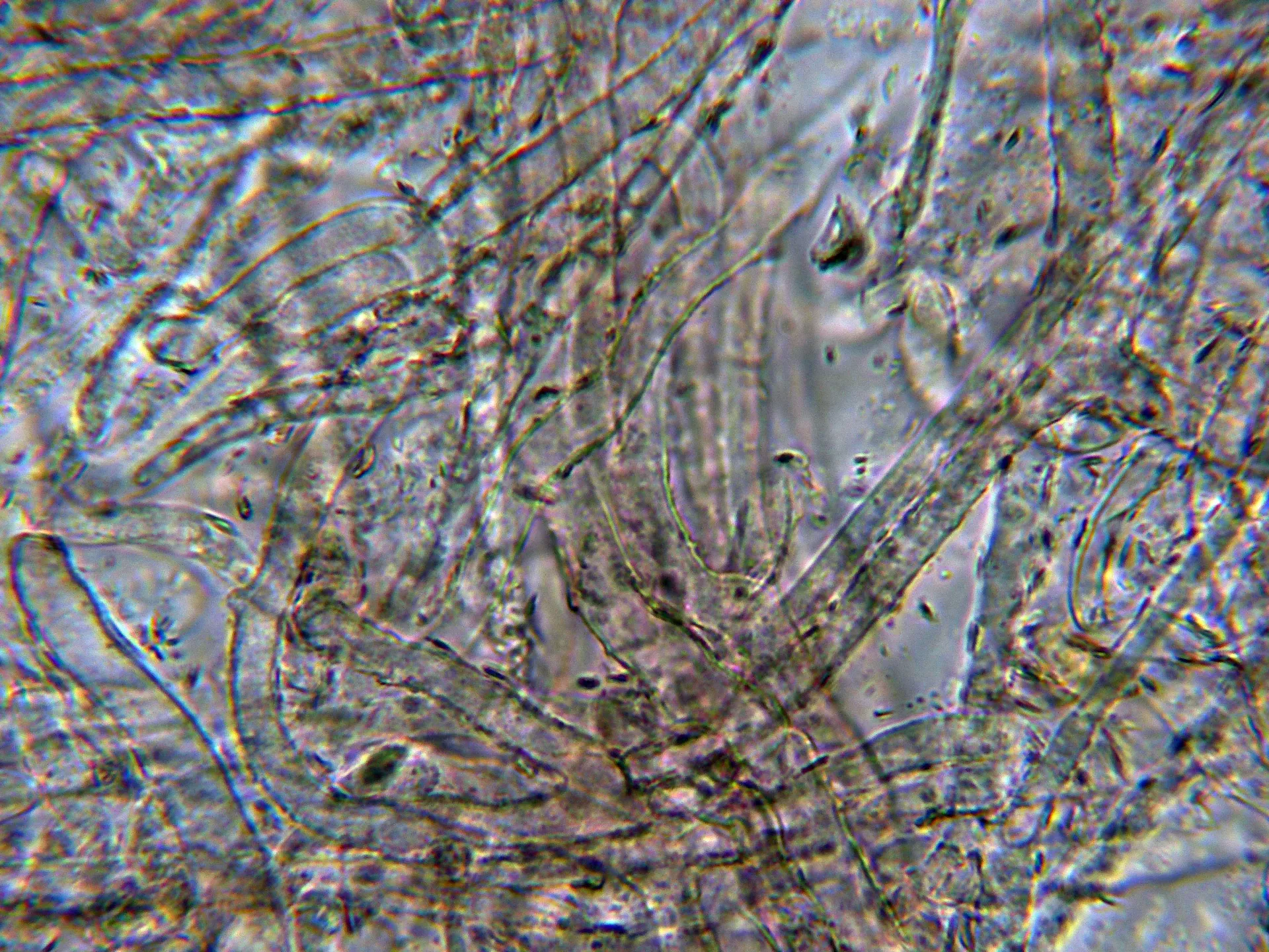 Microscopía de Suillus bovinus - 10 - Subpellis-001